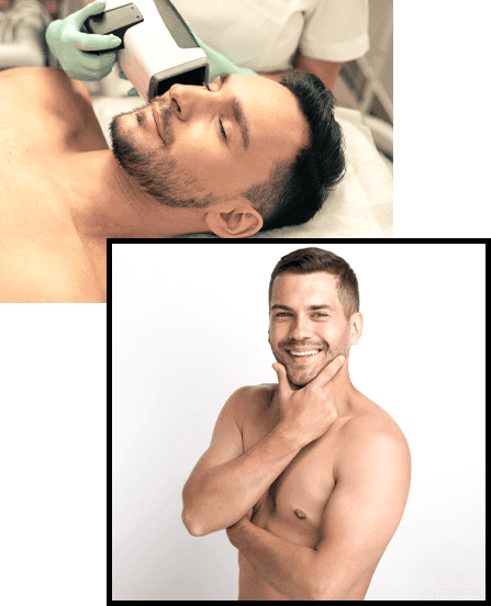 Erkek_Epilasyon_3 (1)